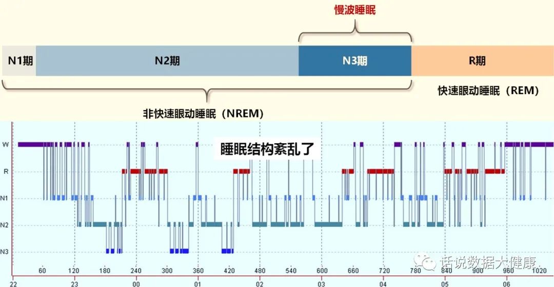 5mg奥氮平代谢多久_奥氮平个体化选择失眠_奥氮平治疗失眠效果